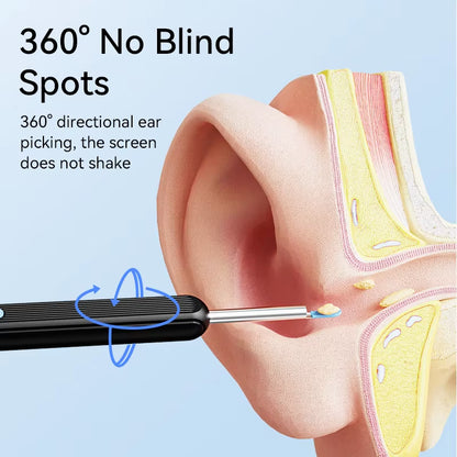 Visual Ear Wax Cleaner with Camera Safe Earwax Removal Endoscope with 5M Camera Luminous Otoscope Ear Cleaning Tools Ear Care